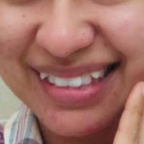 Before Ammara Fatima